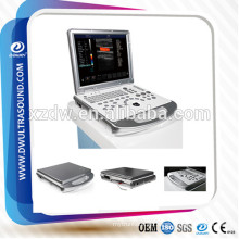 DW-C60 color doppler ultrasound machine &portable doppler ultrasound